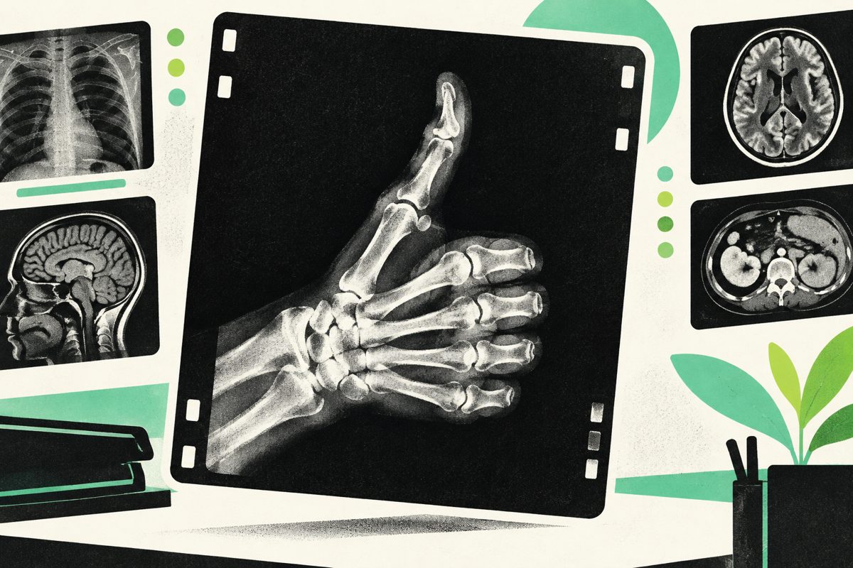 Illustration of a radiograph hand giving a thumbs-up beside scan images